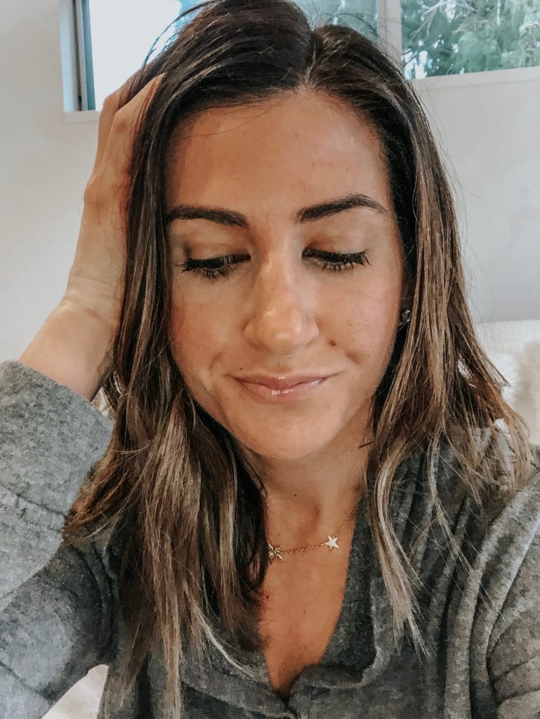 I Had My First Chemical Peel: Here’s What Happened!